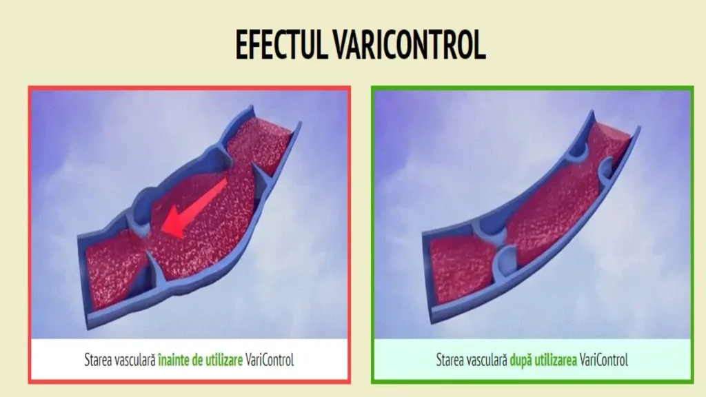 Venicold gel što je to - sastojci - pakiranje - istina o - kako koristiti - sastav - doziranje